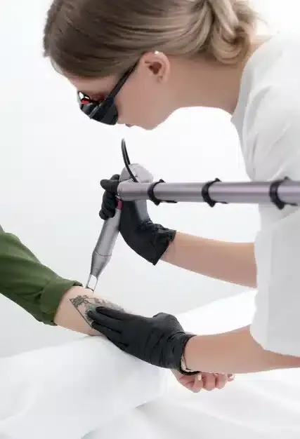 Laser tattoo removal treatment
