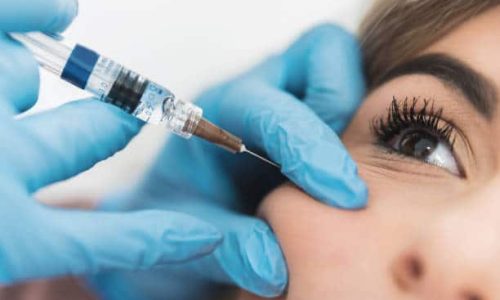Skin rejuvenation consultation
